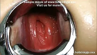 سگ ماده و سیلی انجمن با پرستار, رابطه جنسی آنلاین, مقعد, الاغ او را و پس از آن تبدیل